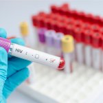 HIV, meno controlli e più