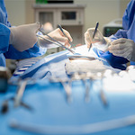 Ottimizzazione prestazioni chirurgiche e smaltimento liste attesa